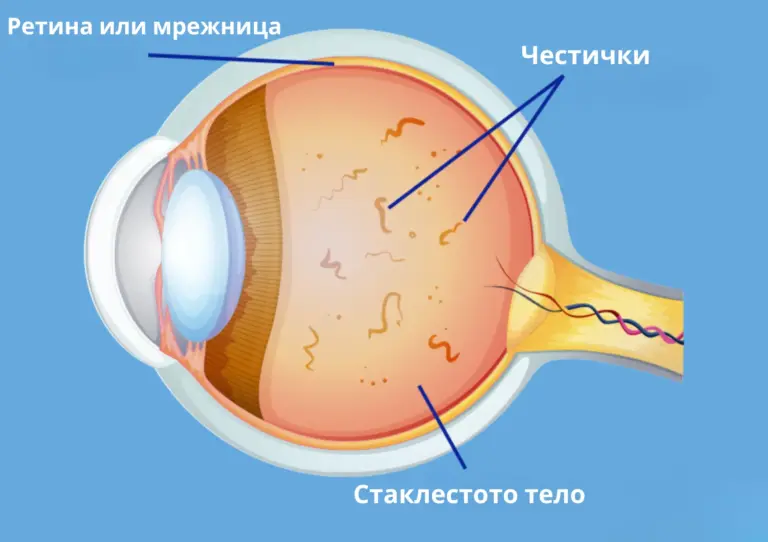 Што се “мушички” во очите или “eye Floaters”